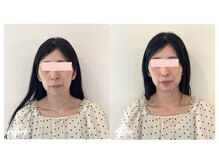 スタイルキューピット(style cupit)/メイクビフォアフター＊40代