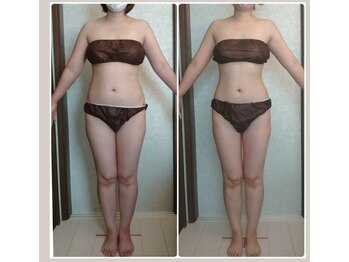 フォルトゥーナ ビューティー(Fortuna Beauty)/