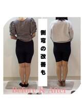 スタイルラボ高松/産後骨盤矯正の効果♪