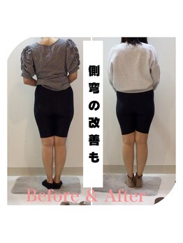 スタイルラボ高松/産後骨盤矯正の効果♪