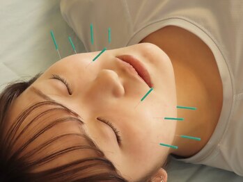 小笠原鍼灸接骨院/美容鍼［所沢/下山口］