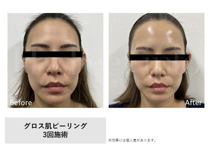ティーナ(Teena)の写真
