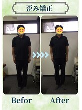 アミーゴ整体院/ビフォーアフター