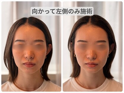 ルーツ 武蔵小杉(R∞ts)の写真