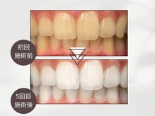 ベネ 錦糸町(bene.)