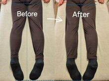 スノー シャイン(SNOW SHINE)/【Before→After】