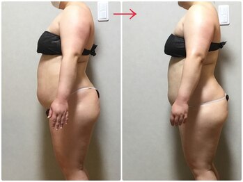 オージャス(OJAS)/40代○○様の変化　痩ボディーへ