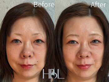 ビースタジオ アクト(B-studio A.c.t.)/HBL