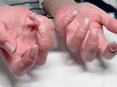 チーク爪先マグネット