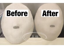 美極 銀座店/銀座/小顔コルギ/小顔矯正