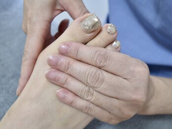 ノーマコルポ(noma corpo)/足指の形崩れ・歪み・痛みも改善