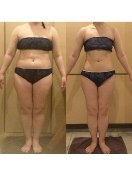 アユアラングレース/大幅減量でも美肌キープ!