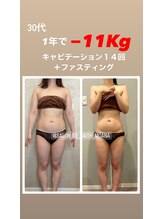 サロン ド フェイス モアナ(Salon de Faith Moana)/キャビテーション１４回【30代】