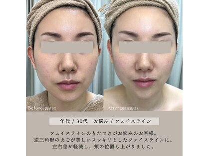 リリーオン 福岡店(RILLEE-ON)の写真