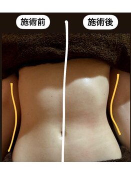 チル 名古屋栄(CHILL)/ビフォーアフター