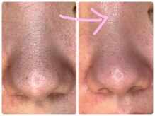 ヒメミ(Himemi)/艶肌Ｗａｘ