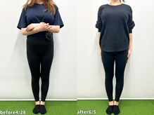 モア 札幌大通店(MORE)/長年の前もものハリが抜けた