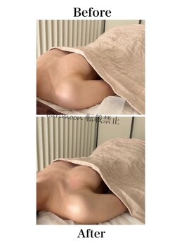 ハリムーン 仙台(harimoon)/ブライダル