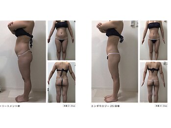 ミネルバエンダモロジー/エンダモロジー/痩身/ウェルネス