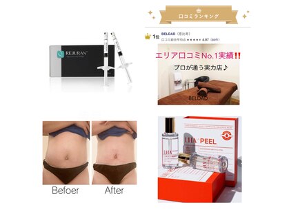 ベルダ (BELDAD)の写真