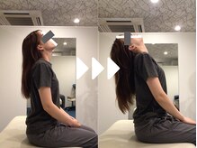 ミライズ整体院 三宮本院/事例【20代女性・首の痛み】