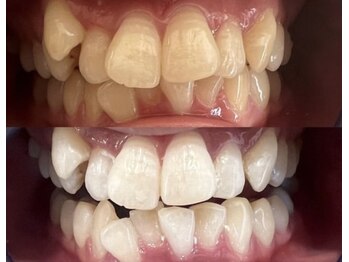 ホワイト 香里園店(WHITE)/3ヶ月後の変化《30代》