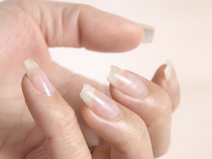 アネル(anel)の写真