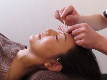 友愛はりきゅう美容整体院の写真/日本美容鍼灸マッサージ協会上級美容鍼灸師の技術を提供!!お悩みの原因を改善し効果を実感◎