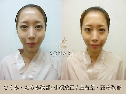 ソナリ(SONARI)の写真