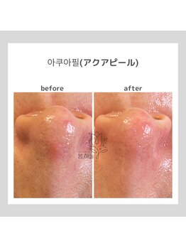 ポムハヌル(pom.haneul)/韓国肌管理室