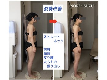 ノリスズ(NORI SUZU)/スマホ首/猫背/反り腰/太もも