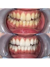 ライトビューティー 池袋店(LightBeauty)/症例写真