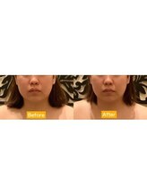 アジール 長岡リバーサイド千秋店(agir)/Before/After画像