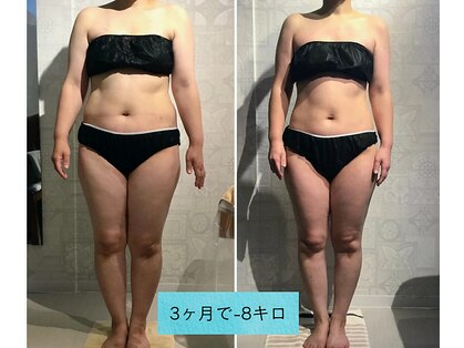 サンテボーテ(Sante Beaute)の写真