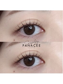 ダイヤモンドアイズ 調布店(DIAMOND EYES)/シンプリフィ(ぱっちり)