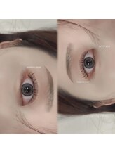 ルーフアイ(ROOF EYE)/ROOF EYE(ルーフ アイ)