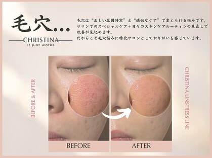 エトワール(etoile)の写真