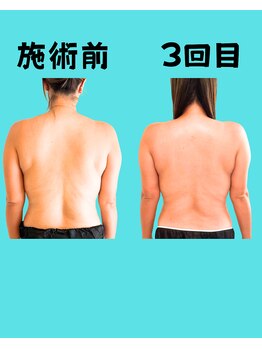 プララ(Plala)/全身強圧リンパ120分