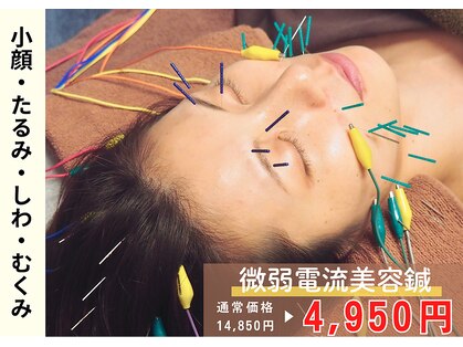 ビハダ(BIHADA)の写真