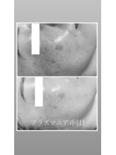 ミュベル(Myubelle)/結果出しが得意なサロン