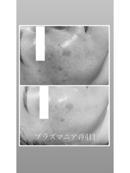 ミュベル(Myubelle)/結果出しが得意なサロン