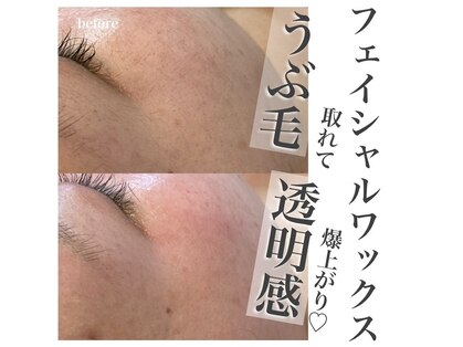 ソイズエステティクスの写真