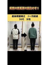 あいの心鍼灸整体院/ビフォーアフター