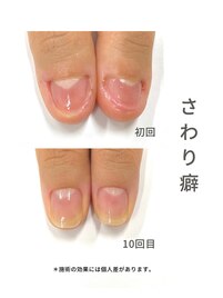 最強ネイルケア