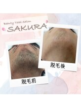 ビューティブロス(Beauty Bros)/