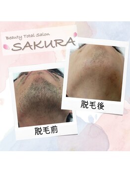 ビューティブロス(Beauty Bros)/