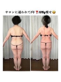 シュシュ エステティックアンドヨガ(chouchou esthetique&yoga)/3週に1回ペースで1年間の結果