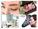 ミノンリープ(Mignon Leap)の写真