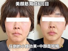 リエル(RIEL)/【美顔筋育成】