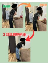 楽する鍼灸 整骨院 南福岡院/